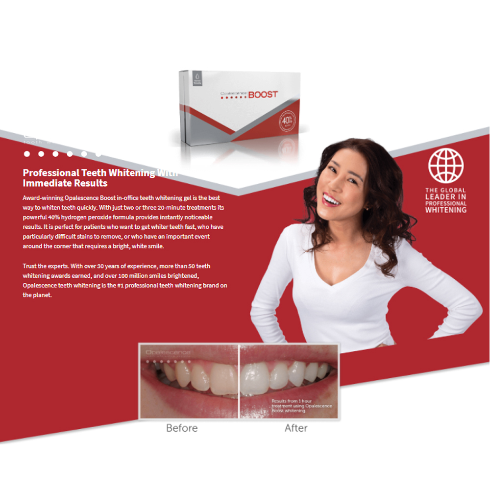 Opalescence Boost 40% PF Ameri - Teeth Whitening Gel Opalescence 评论和价格