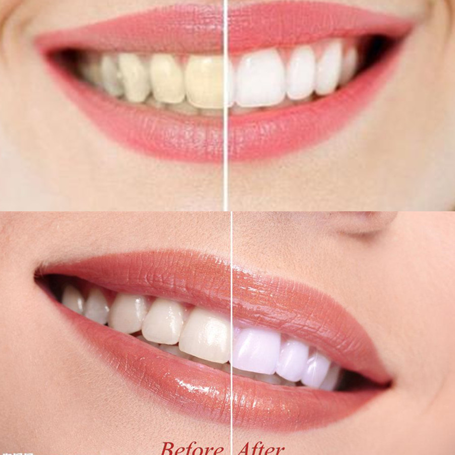 Bamboo Charcoal Teeth Tooth De - Teeth Paint Whitening 评论和价格