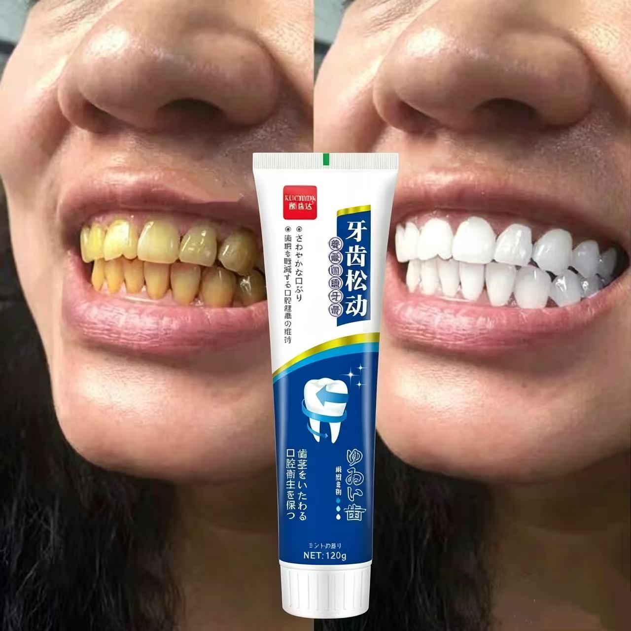 Fix Loose Teeth Japanese Impor - Teeth Whitening Japan 评论和价格