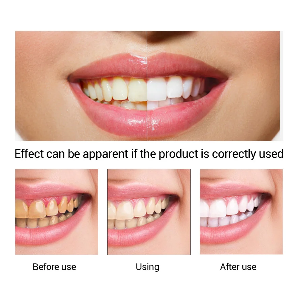 FTEENPLY Teeth Whitening Essen - Teeth Whitening Powder 评论和价格