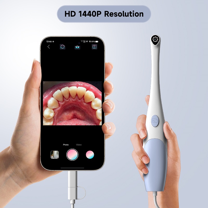 Oral Endoscope Camera 1440P Ph - Teeth Whitening Video 评论和价格