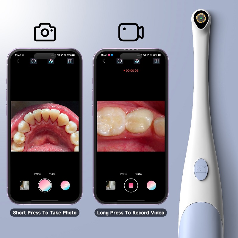 Oral Endoscope Camera 1440P Ph - Teeth Whitening Video 评论和价格