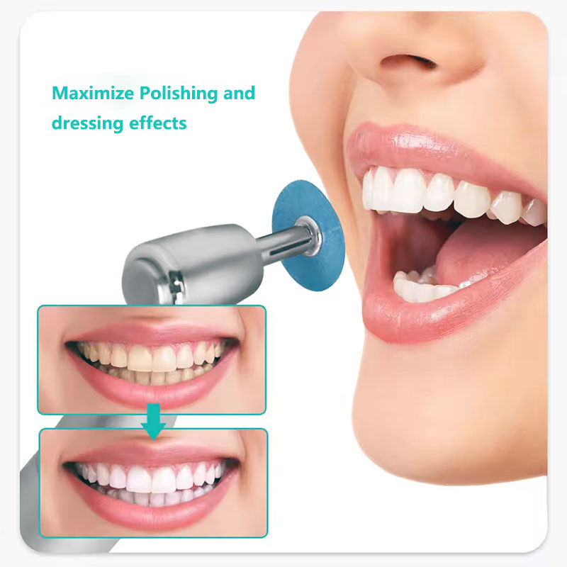 40pcs Dental Polishing Discs H - Whitening Teeth Dentist 评论和价格