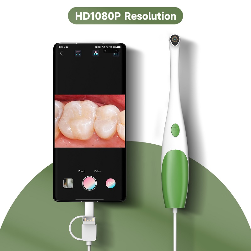 TYPE-C Oral Endoscope Handheld - Teeth Whitening Video 评论和价格
