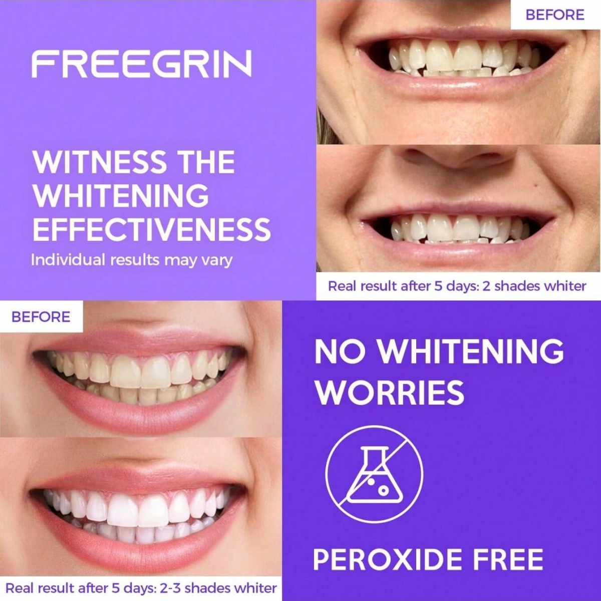 Deluxe Whitening Teeth Sticker - Teeth Whitening Remedies 评论和价格